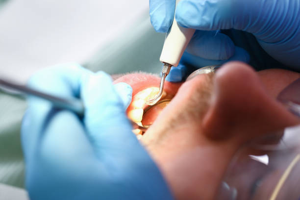 Best Emergency Dental Care for Broken or Chipped Teeth in Capitol View, SC