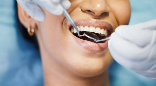 Best Emergency Gum Treatment in Capitol View, SC