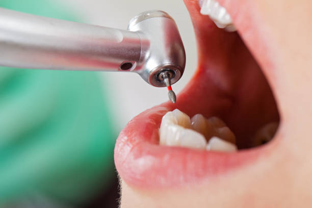 Best Emergency TMJ Treatment in Capitol View, SC